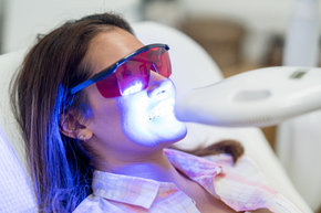 Teeth Bleaching menggunakan LED Light Activator, termasuk Scaling dan Fluoride Coating di Dentistique Clinic