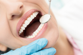 Front Tooth/ Incisive Root Canal Treatment di Dentistique Clinic