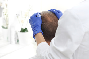 Anti Hair Loss Therapy di Genese Clinic