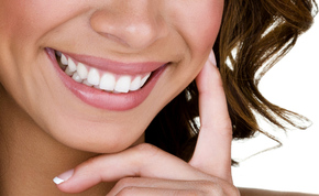 Bleaching + Scaling di Tidi Dental Clinic