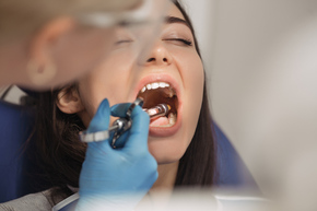 Composite Crown 1x di Dentistique Clinic