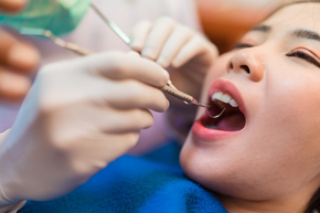 Tambal Gigi Lubang Kecil 1X di Agata Dental Clinic
