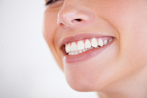 Scalling + Stain Removal + Polishing + Fluoride + Dental Check Up dengan Intraoral Camera di A8 Dental