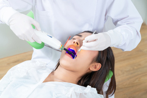 Perawatan Saluran Akar 1 Akar Gigi Depan di Agata Dental