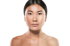 Paket Brightening 1x di Klinik Estetik Ambrosia
