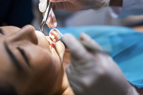 Scaling & Stain + Polishing + APD 1x di My Dental Studio