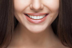 Bleaching gigi 1x di Empire Dental Studio