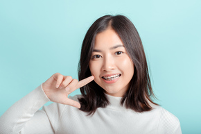 Pemasangan kawat gigi Metal 1x di Mydentismile