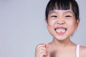 Pencabutan Gigi Susu 1x di Mydentismile