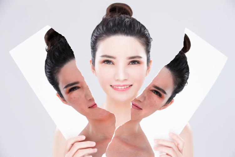 Injeksi Flek 1x di Klinik Derven Dermatology