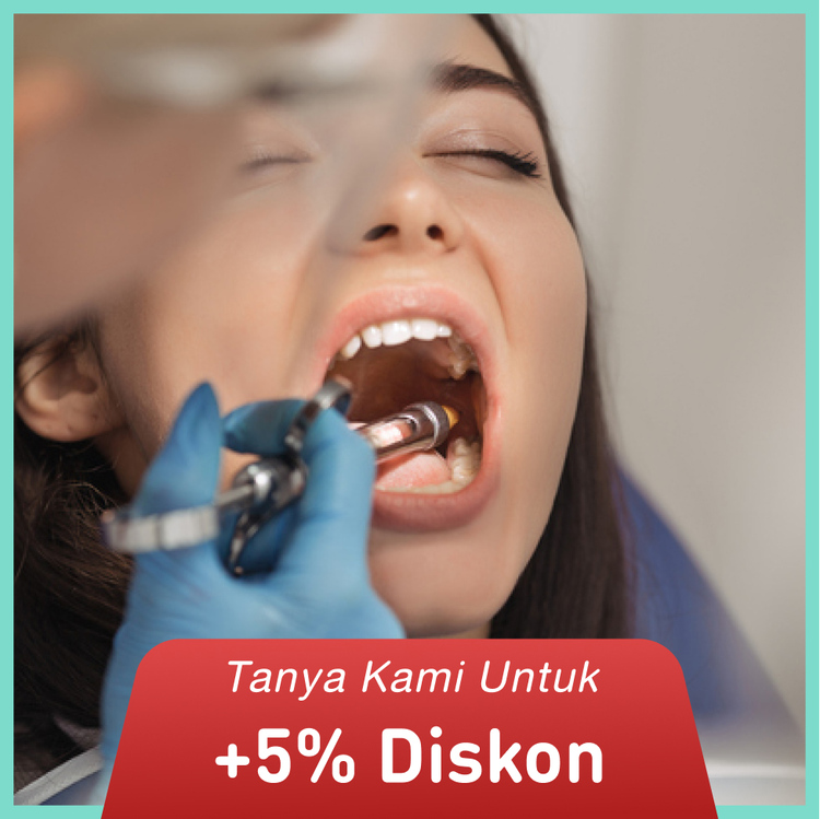 Composite Crown 1x di Dentistique Clinic