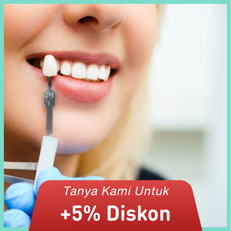 Crown lengthening untuk 1 regio di Dentistique Clinic