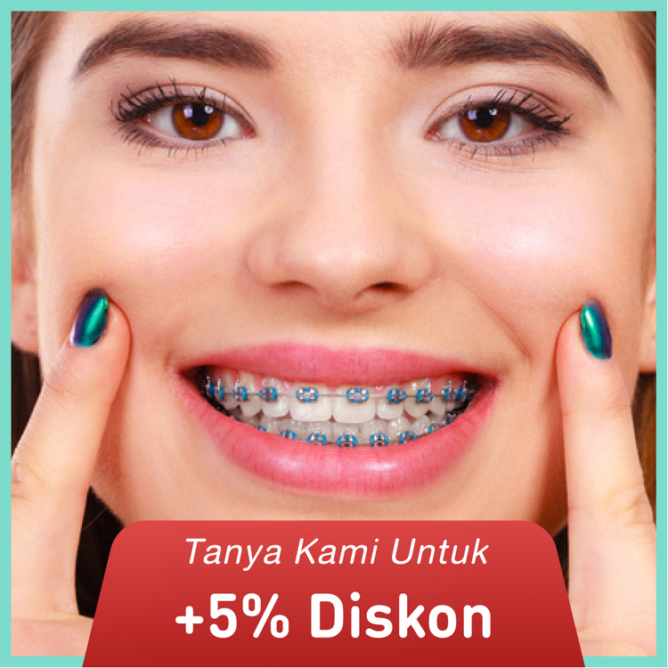 Metal Braces dengan Drg. Sp Ort 1x di Dentistique Clinic
