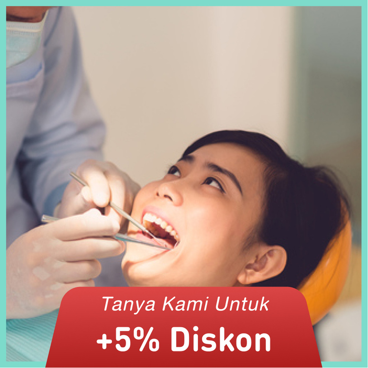 Molar Root Canal Treatment di Dentistique Clinic