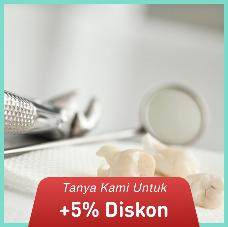 Odontektomi (Pencabutan gigi bungsu) + Konsultasi di FD Care