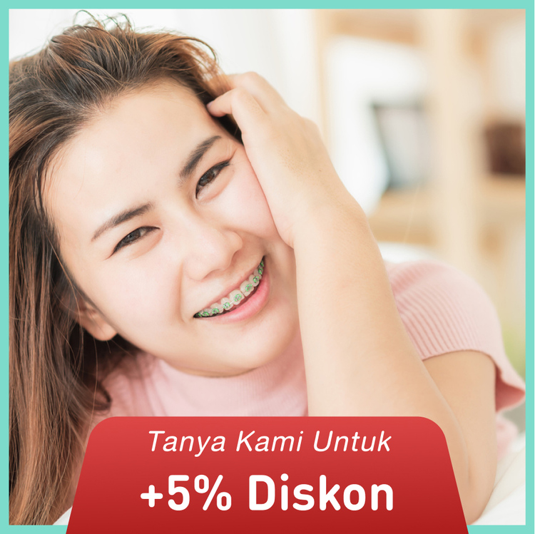 Pemasangan Behel/Bracket Metal Standart 1x di Champion Dental Care