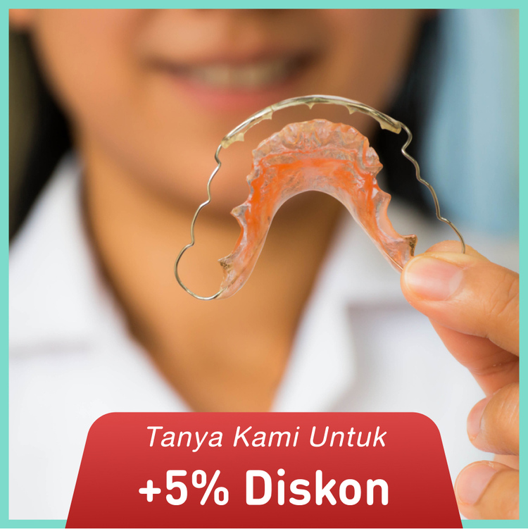 Retainer Hawley per Rahang 1x di Dentistique Clinic
