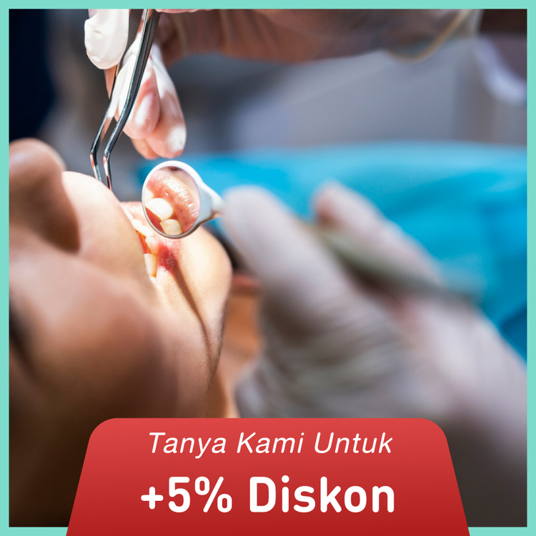 Scaling & Stain + Polishing + APD 1x di My Dental Studio