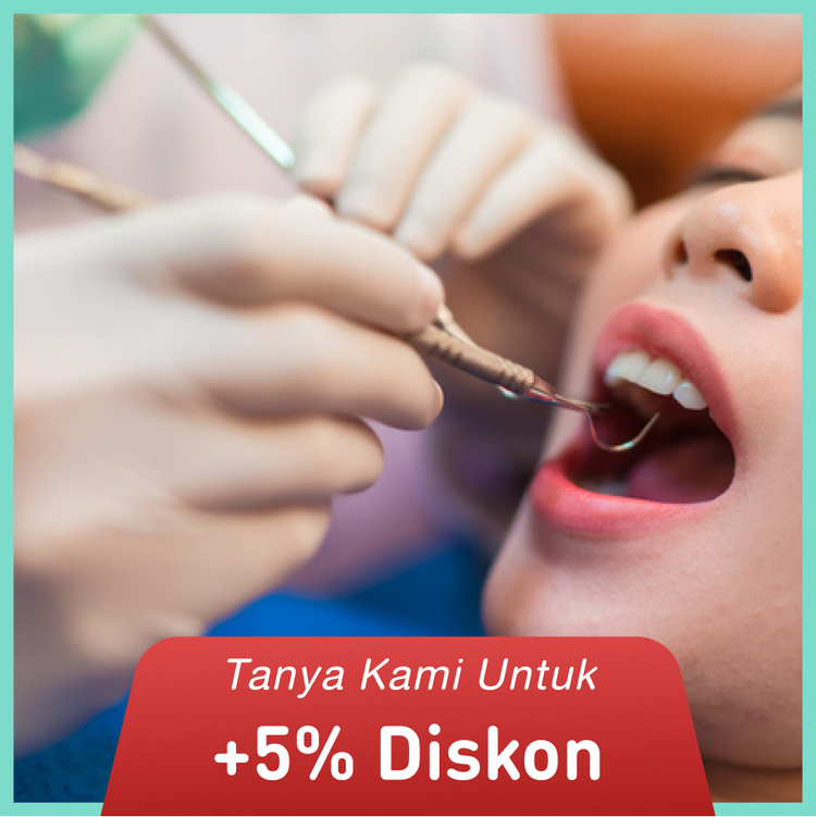 Tambal Gigi Lubang Kecil 1X di Agata Dental Clinic