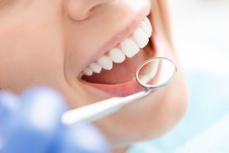 Scaling, Dental Polishing, Fluoride Coating, dan Oral Health Examination di Dentistique clinic