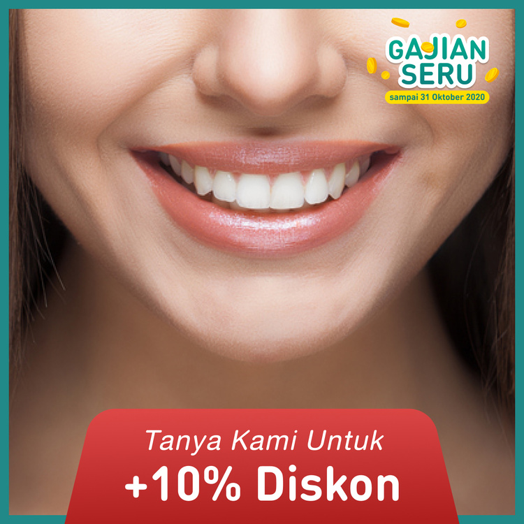 Bleaching gigi 1x di Empire Dental Studio