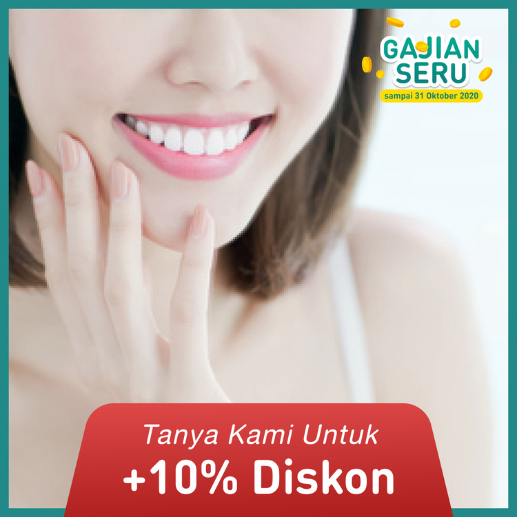 Bleaching (Pemutihan Gigi) dengan Sinar + Konsultasi 1x di FD Care