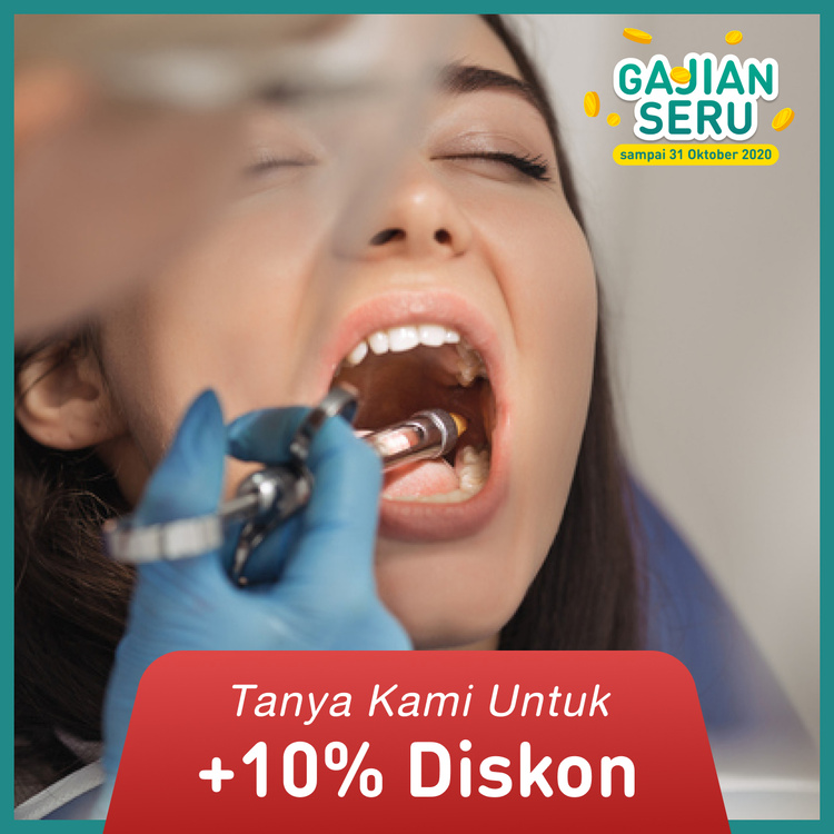 Composite Crown 1x di Dentistique Clinic