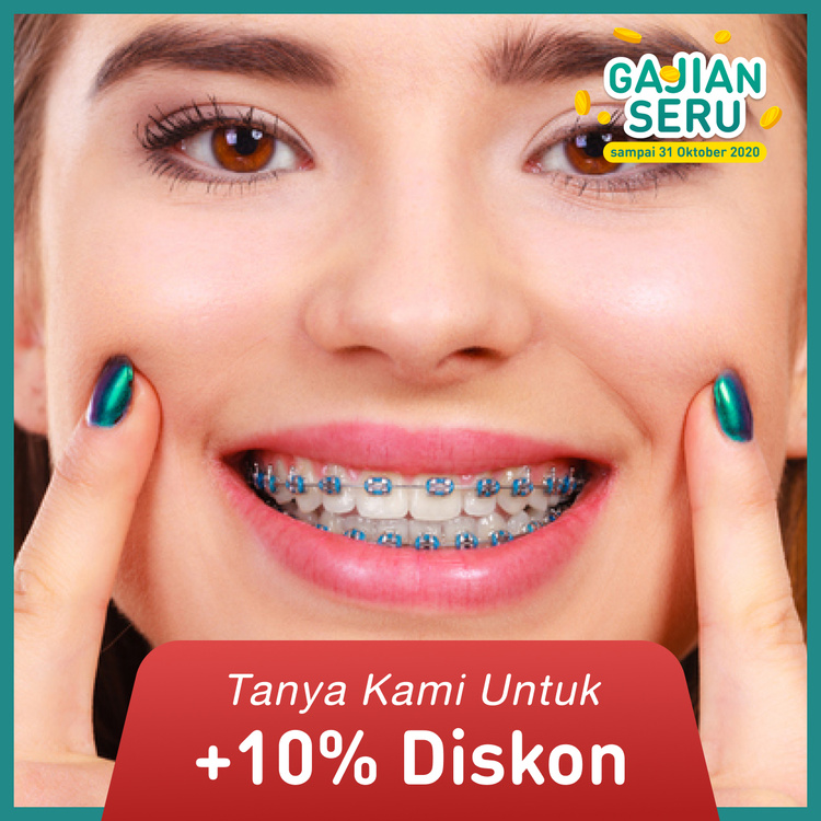 Metal Braces dengan Drg. Sp Ort 1x di Dentistique Clinic