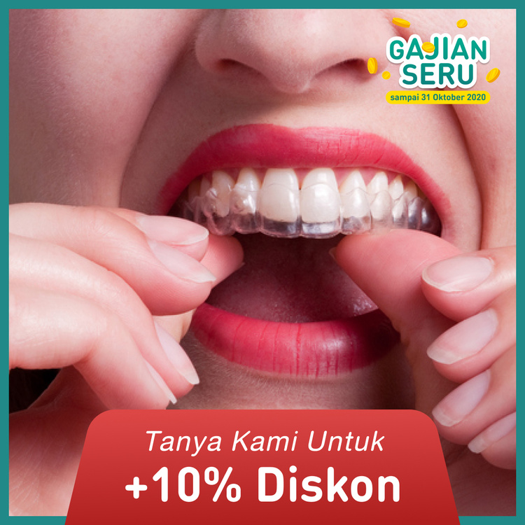 A Pair of Clear (Essix) Retainer di Dentistique Clinic