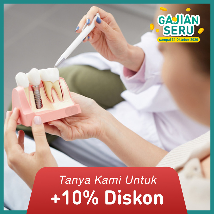 Paket Implan + Abutment + Crown gigi 1x di Mydentismile