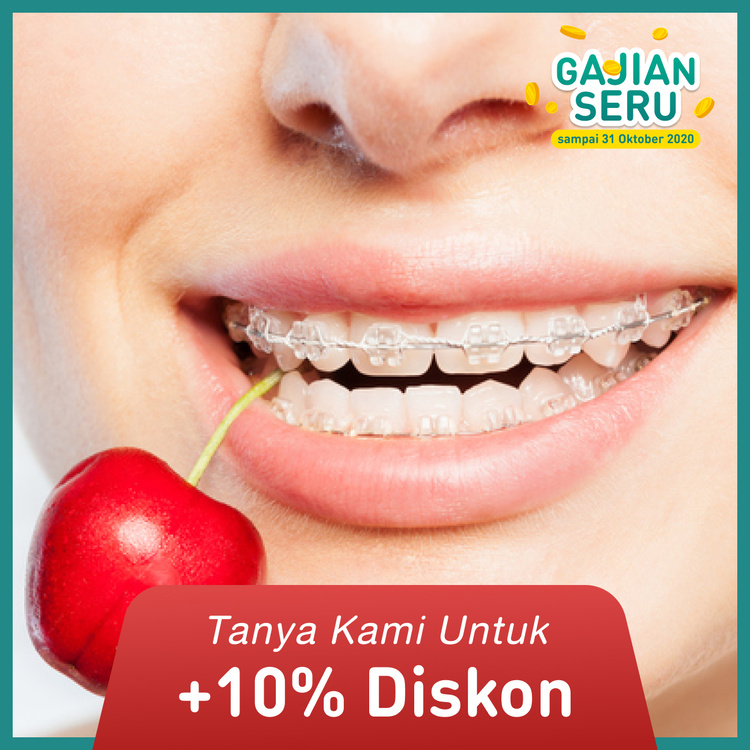 Pemasangan behel / Sapphire Braces from America + APD 1x di My Dental Studio