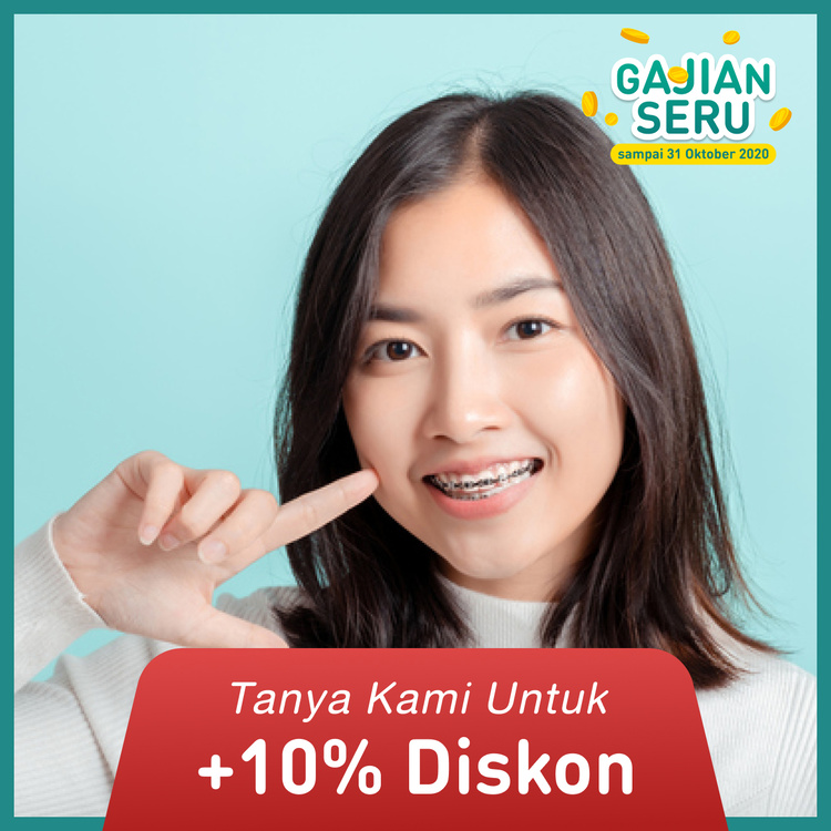 Pemasangan kawat gigi Metal 1x di Mydentismile