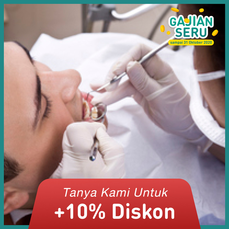 Pembersihan Karang gigi (Scaling) 1x di FD Care