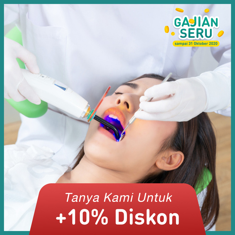 Perawatan Saluran Akar 1 Akar Gigi Depan di Agata Dental