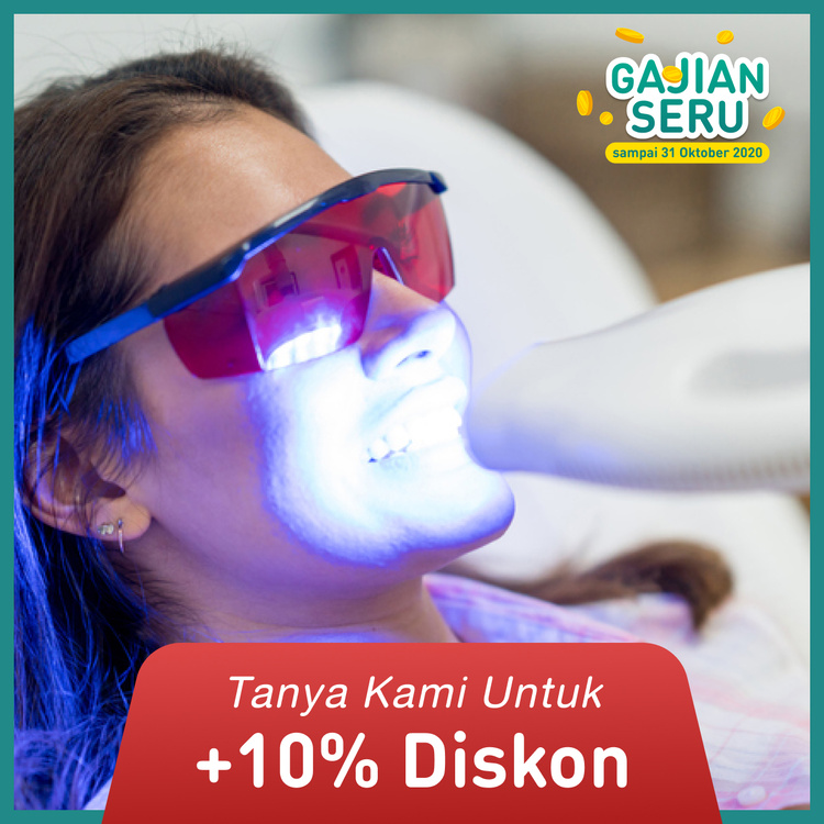 Teeth Bleaching menggunakan LED Light Activator, termasuk Scaling dan Fluoride Coating di Dentistique Clinic