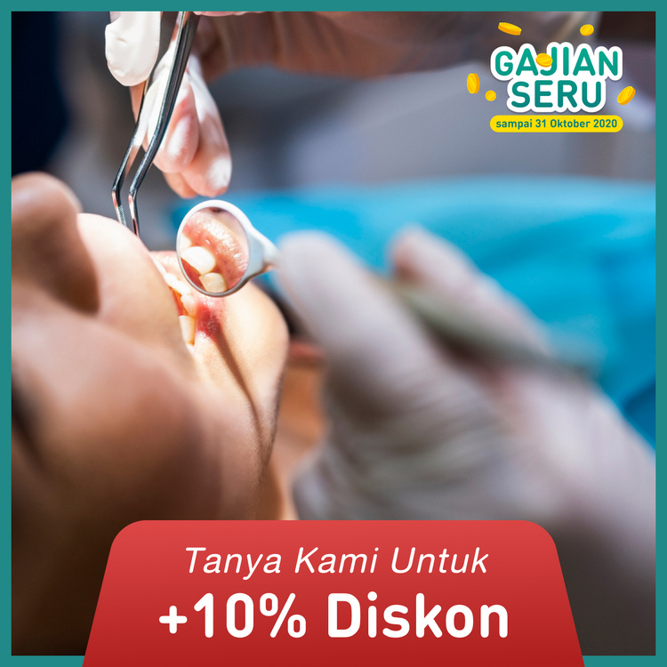 Scaling & Stain + Polishing + APD 1x di My Dental Studio