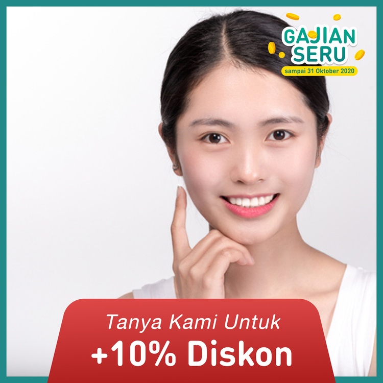 Veneer Direct 10 gigi di Mydentismile