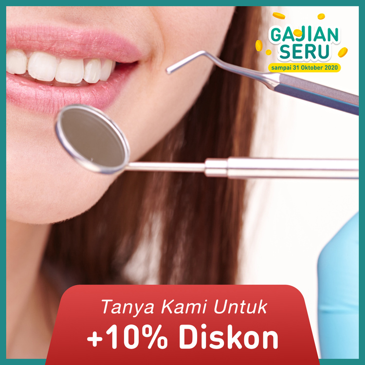 Veneer Indirect Porcelain 1x di Agata Dental Clinic