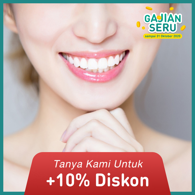 Whitening / Bleaching gigi 1x di Mydentismile