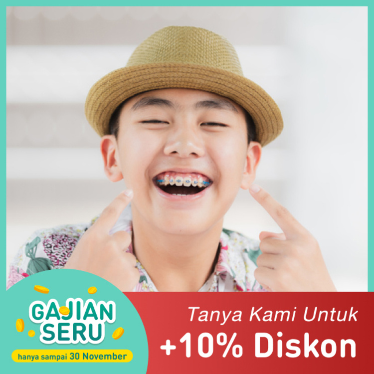 Clear Braces / Ice Sapphire dengan Sp Ort 1x di Dentistique Clinic