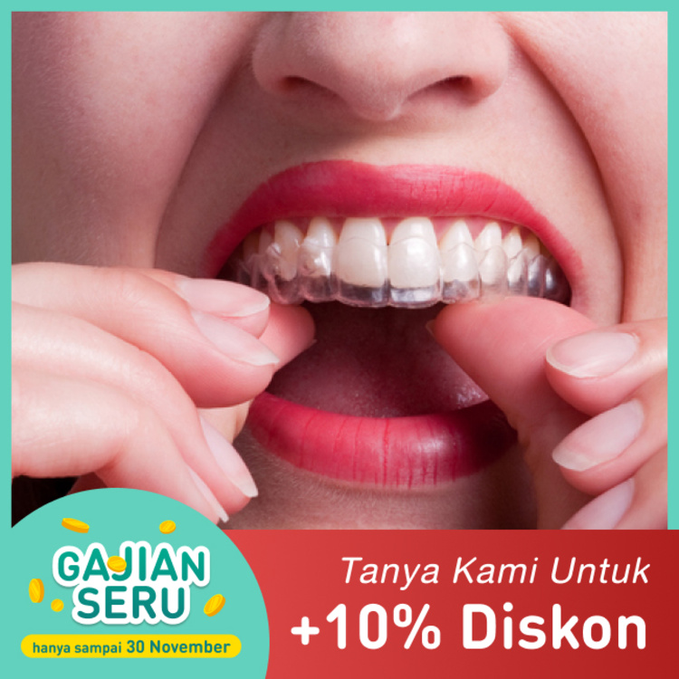 A Pair of Clear (Essix) Retainer di Dentistique Clinic