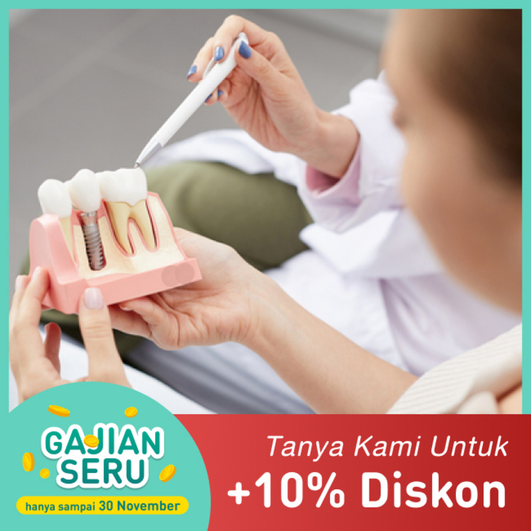 Paket Implan + Abutment + Crown gigi 1x di Mydentismile