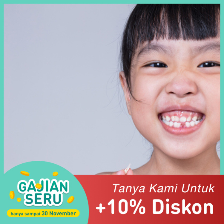 Pencabutan Gigi Susu 1x di Mydentismile
