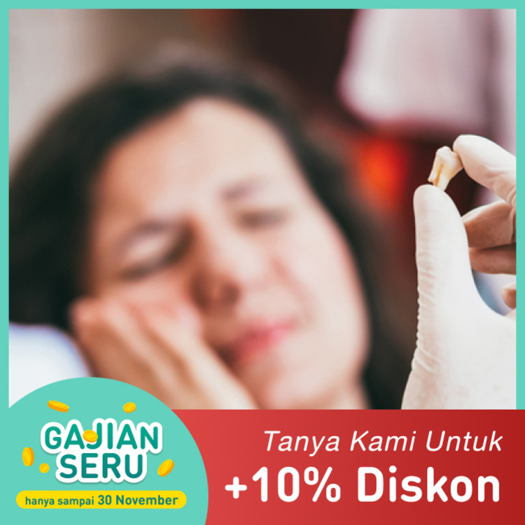 Pencabutan Gigi Tetap / Permanen 1x di Mydentismile