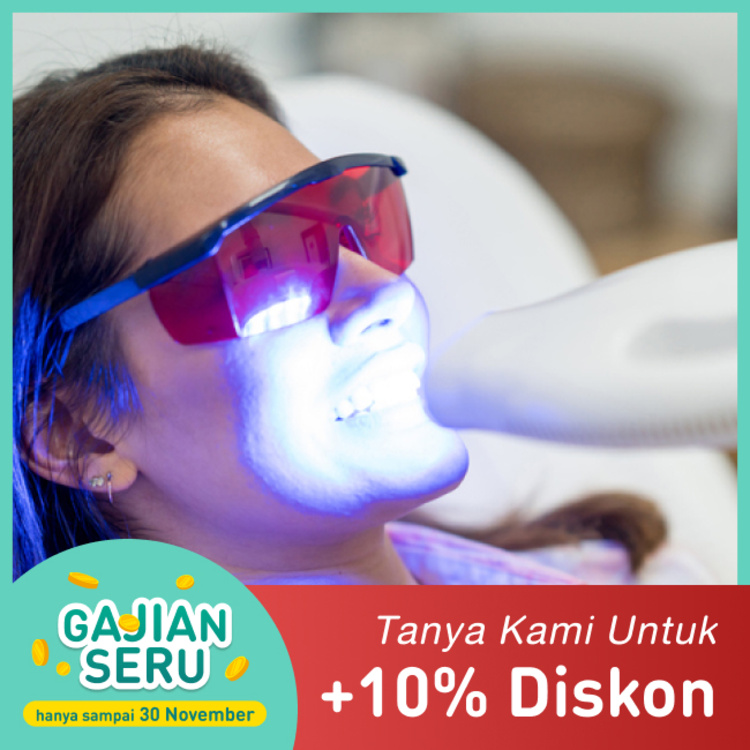 Teeth Bleaching menggunakan LED Light Activator, termasuk Scaling dan Fluoride Coating di Dentistique Clinic