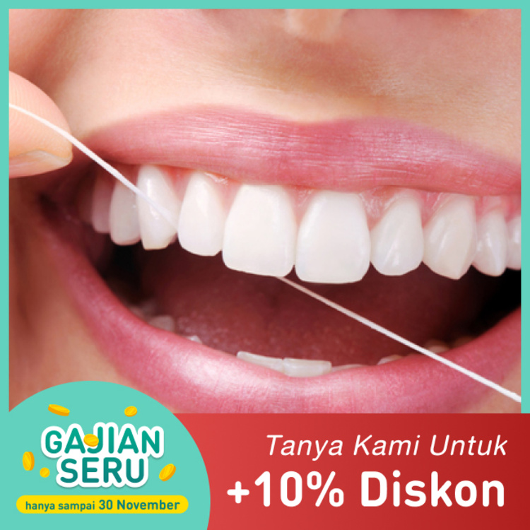 Teeth Whitening (Pemutihan Gigi) / Bleaching 1x Dental Theory Clinic JGC