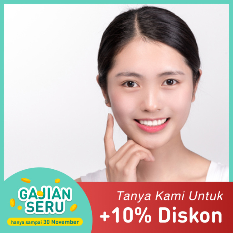 Veneer Direct 10 gigi di Mydentismile