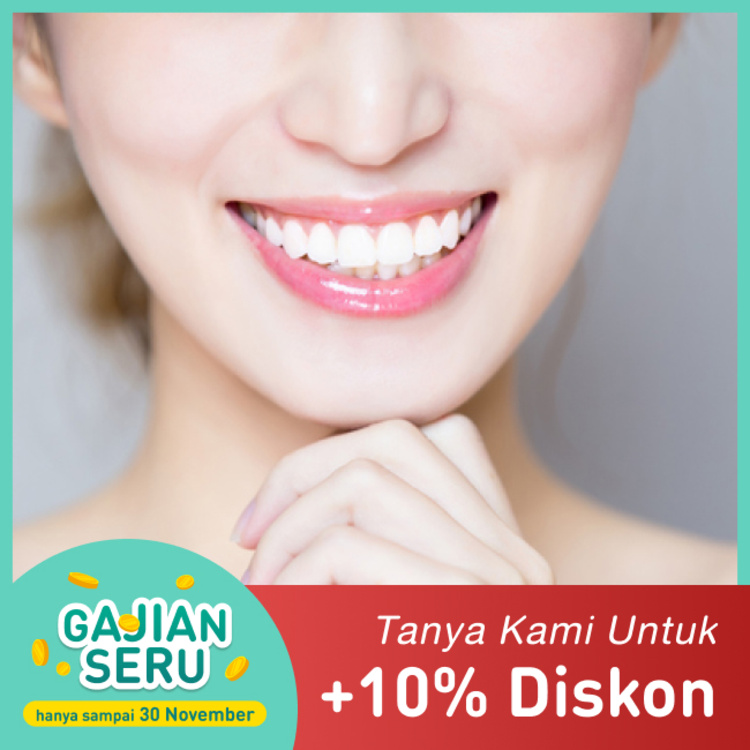 Whitening / Bleaching gigi 1x di Mydentismile