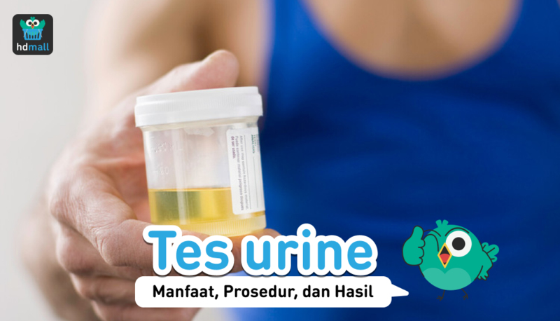 Tes Urine