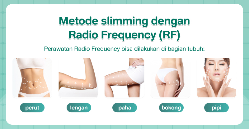 Metode slimming dengan Radio Frequency